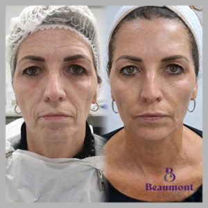 Expert Facial Treatment Guide