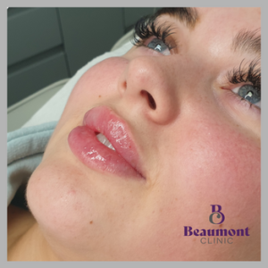 Botox anti-wrinkle injection treatment at professional aesthetics clinic