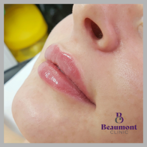 Beaumont Clinic aesthetic treatment image from professional clinic gallery